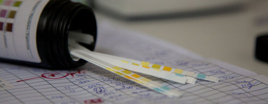 How Long is CBD Detectable in Urine? A Guide