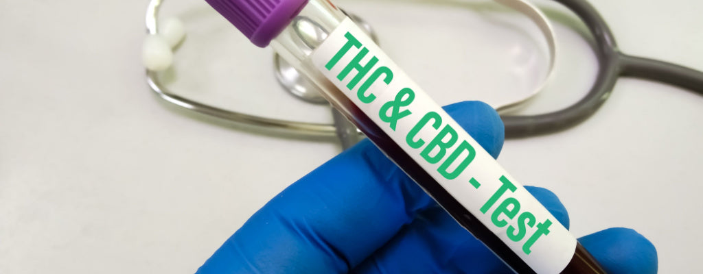 Will Delta 8 Show Up on Drug Tests?